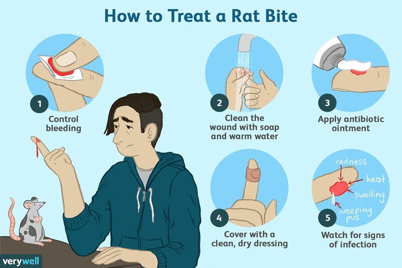 how to treat rat bites